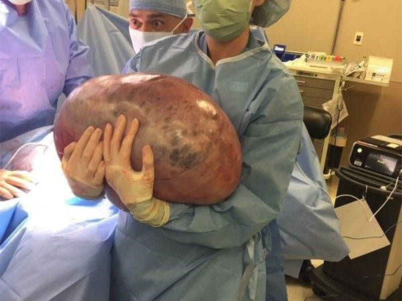 بالصور: لن تصدق ما استخرجه الأطباء من جسد هذه الفتاة!